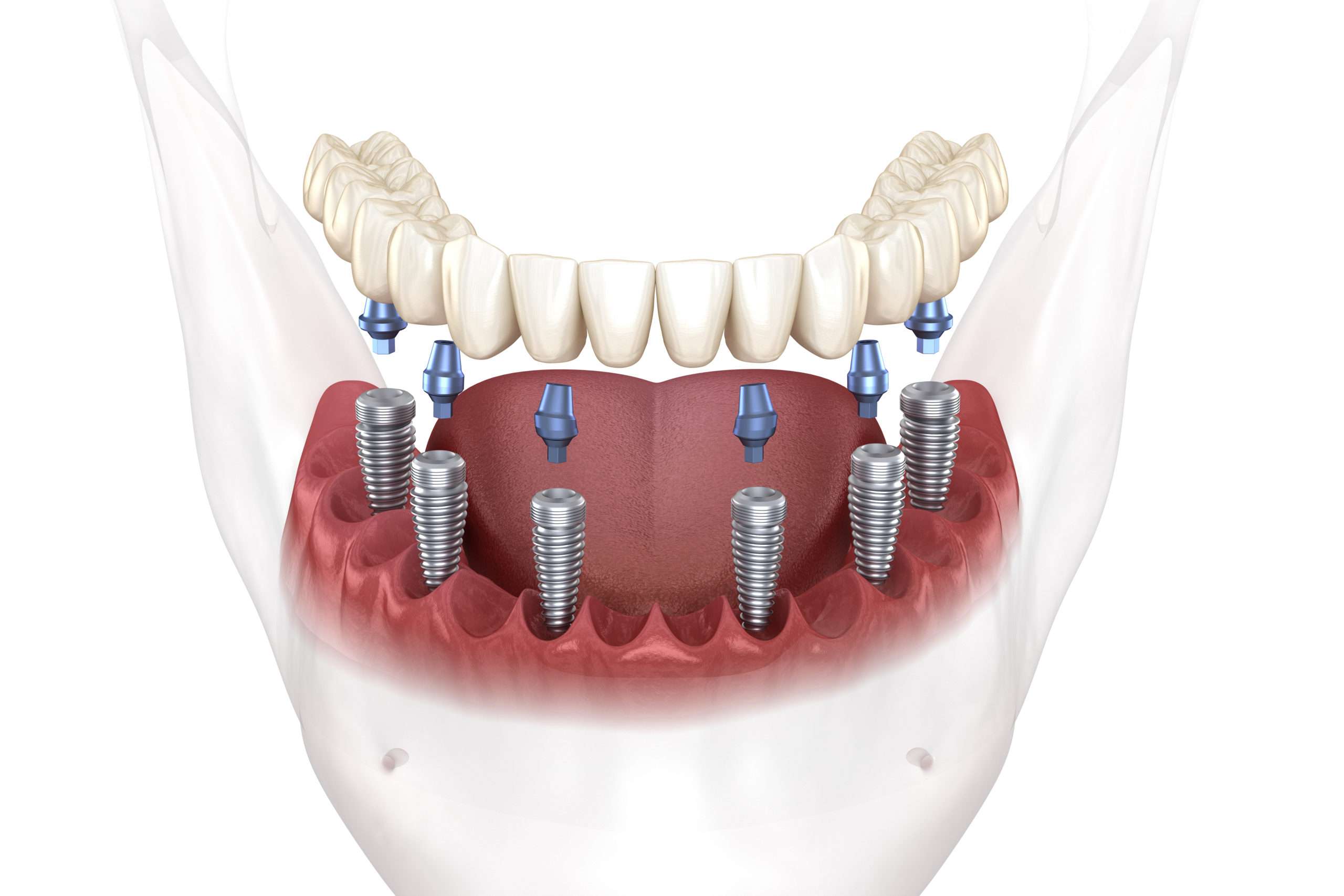Best of the Best Dental Services in Houston