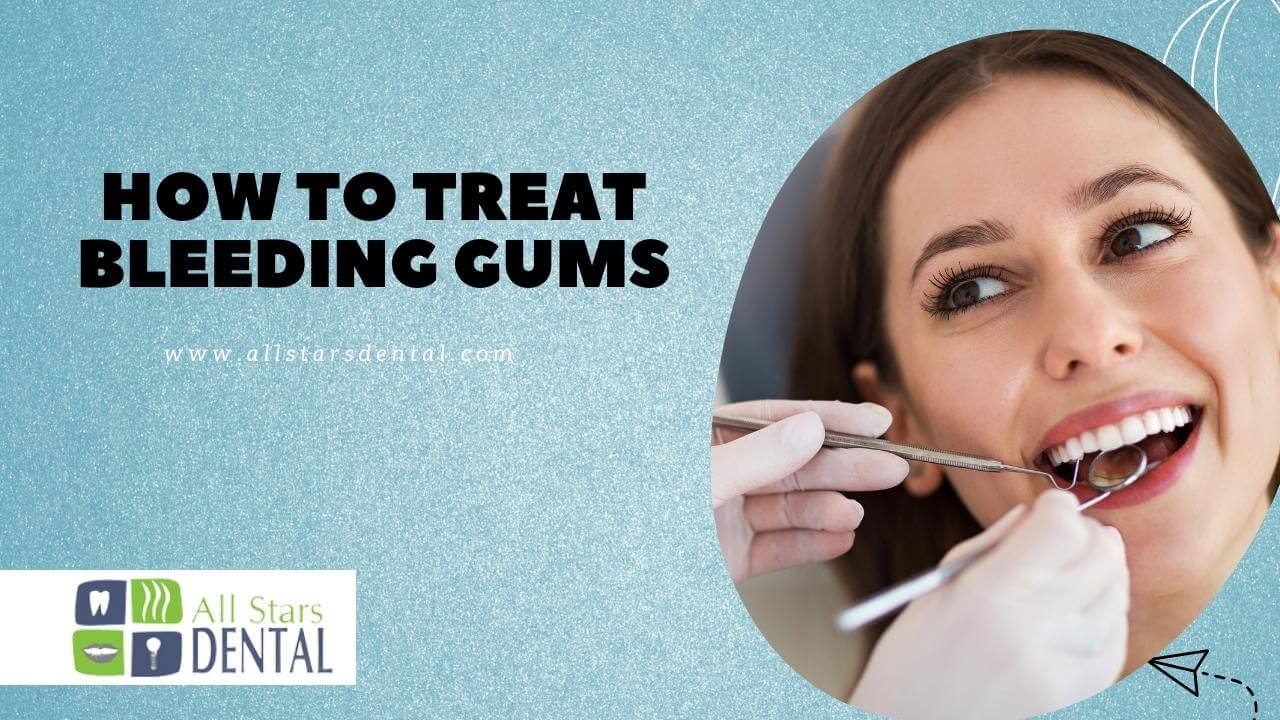 Guideline For How to Stop Bleeding Gums After Dental Work