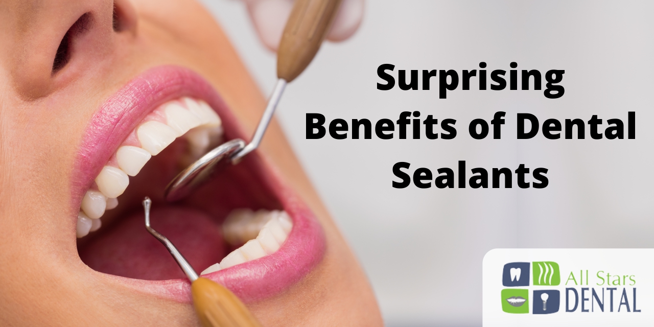Discover the Surprising Benefits of Dental Sealants
