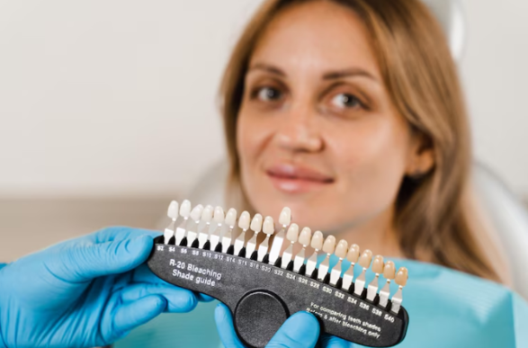 The Step-by-Step Process of Getting Porcelain Dental Veneers