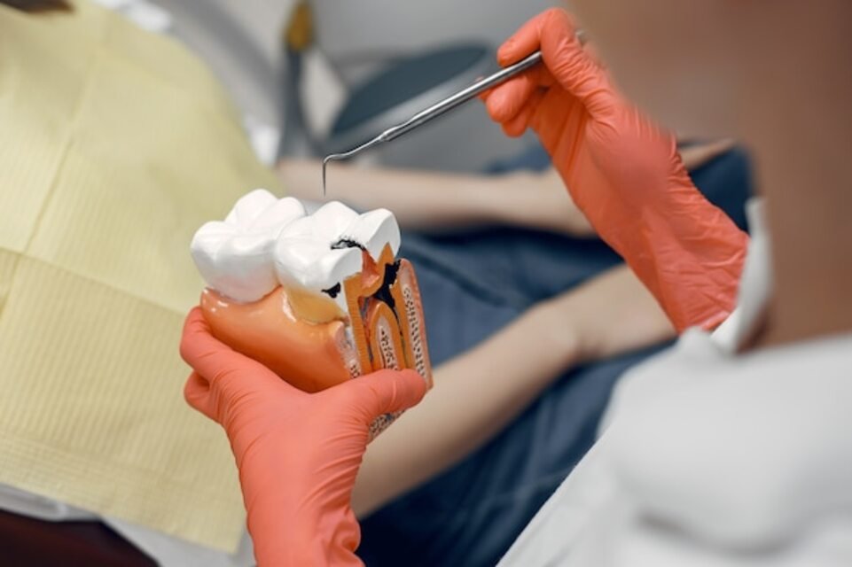 Dental Sealant Procedure: What to Expect From It