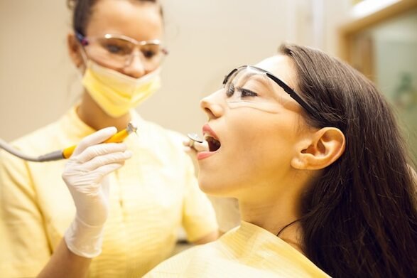 7 Major Benefits of Applying Dental Sealants