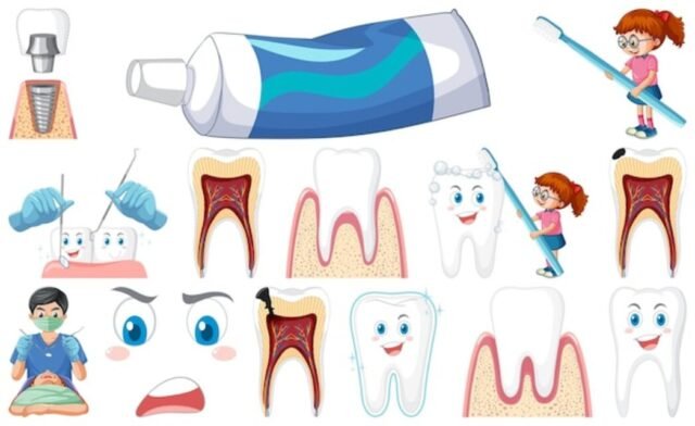 dental sealants in Houston 