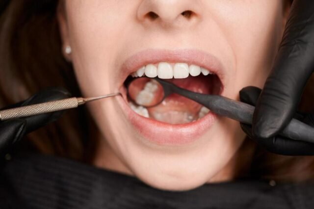 dental reconstruction in Houston