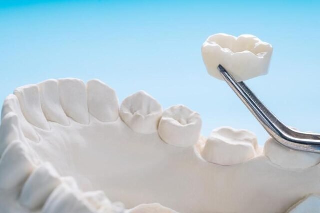 Dental Reconstruction In Houston