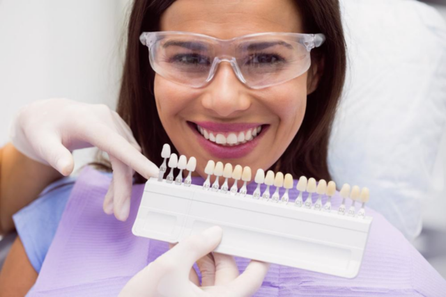 sealers for teeth Houston 