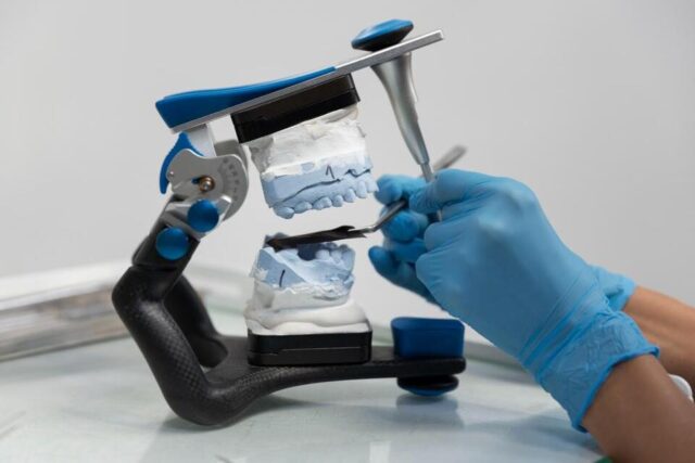 Dental Implant Restoration