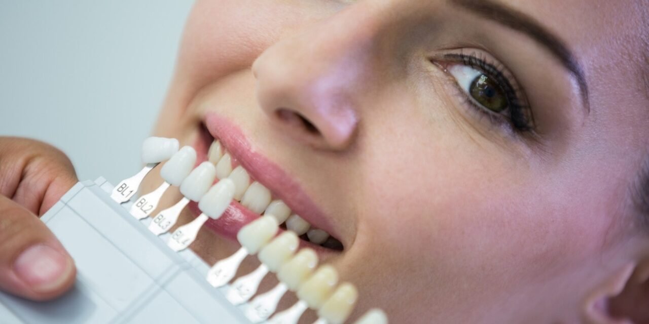 How to Identify the Best Dental Implants for Your Needs