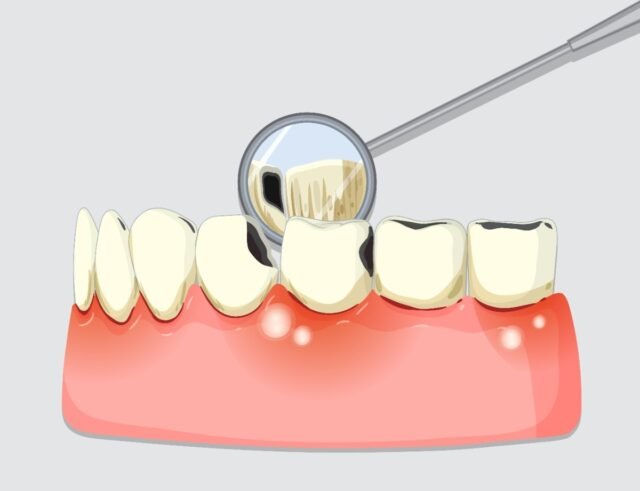 https://allstarsdental.com/wp-content/uploads/2025/10/all-star-dental-6-640x491.jpg