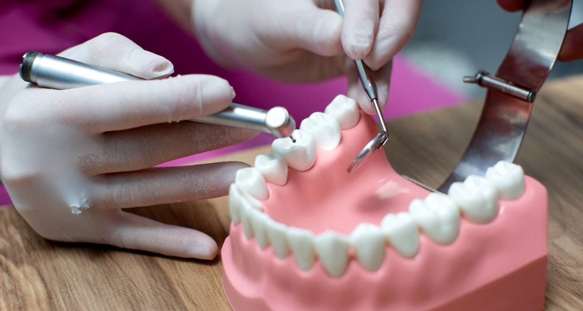 When Dentists Recommend Dental Crowns Instead of Fillings