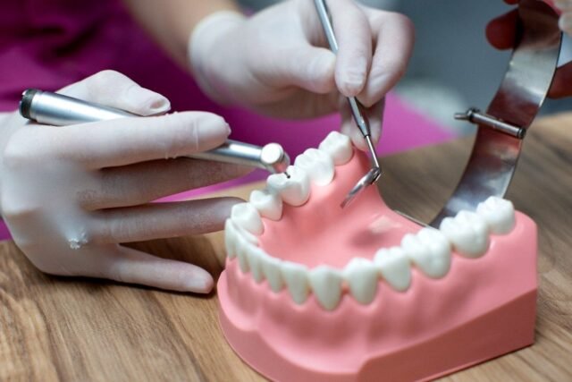 https://allstarsdental.com/wp-content/uploads/2025/10/dental-crowns-2-640x427.jpg
