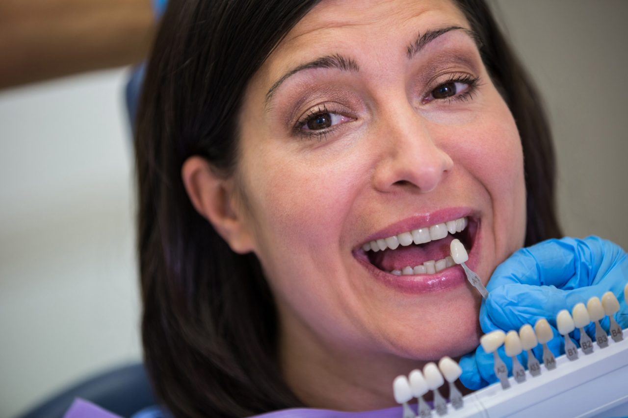 Signs a Dental Crown May Be Better Than a Filling