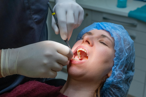 Tooth Extraction vs. Root Canal: Which One Is Better?