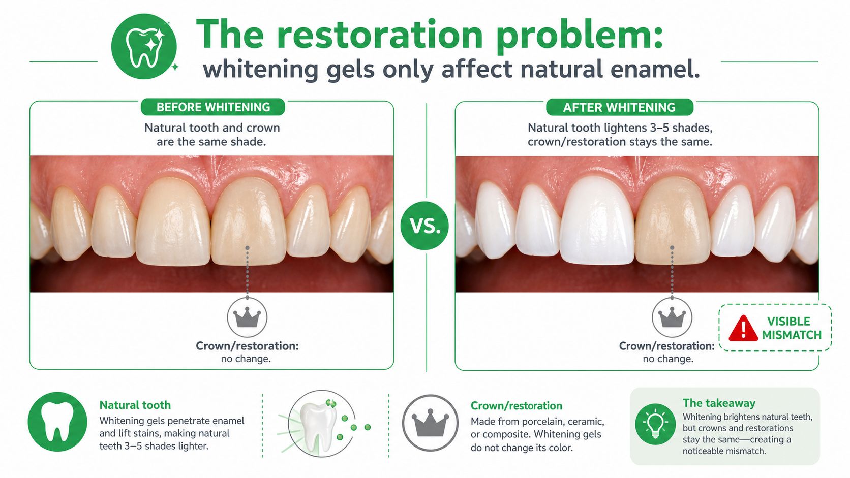 A comparison image showing teeth before and after whitening, illustrating how dental crowns do not change color.