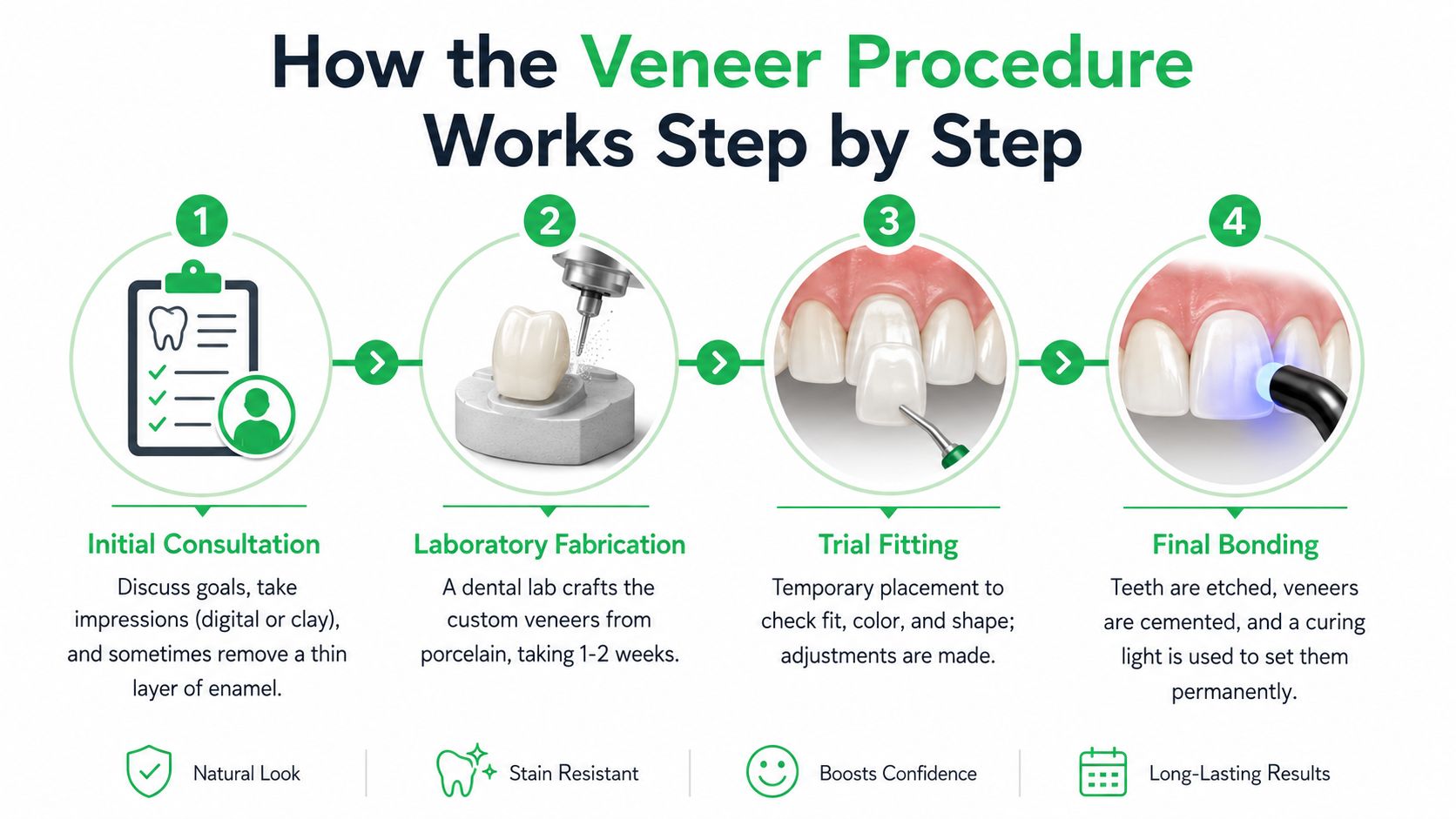 An infographic showing the four-step process for dental veneer placement from consultation to final bonding.
